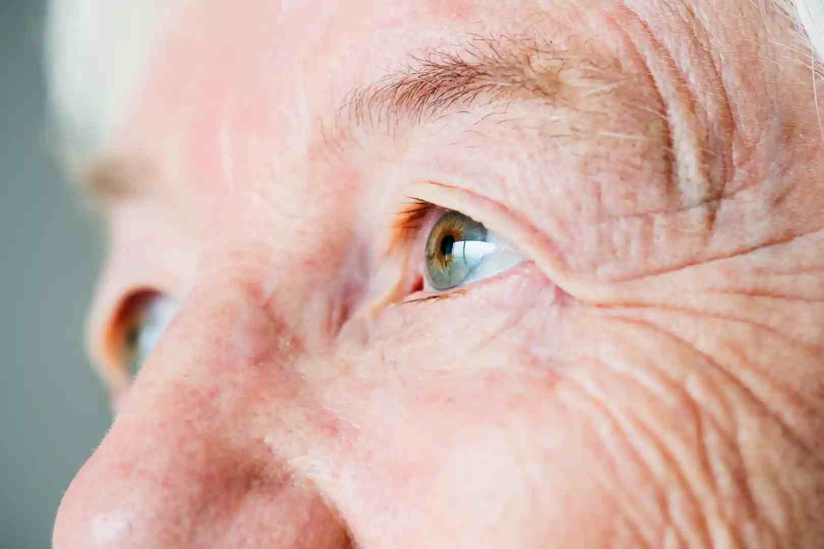 Tallahassee Cataracts